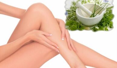 Treatment of varicose veins of the lower extremities with popular remedies