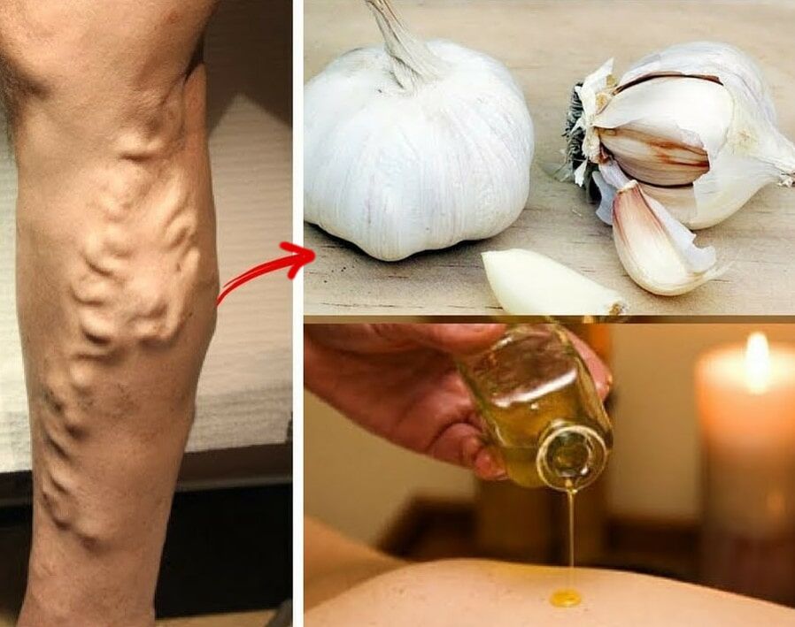 Medications for varicose veins