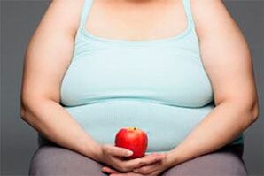 To cure varicose veins it is necessary to lose weight.