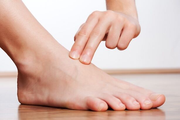 Leg without varicose veins after laser treatment