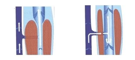 Good functioning of the venous pump.