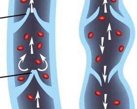 functioning of the valvular apparatus of the veins of the lower extremities