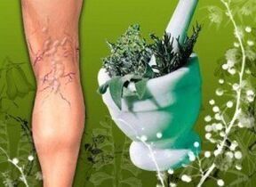 Traditional medicine in the fight against varicose veins of the lower extremities. 