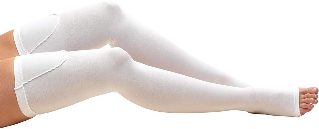 To treat varicose veins it is necessary to use compression stockings. 